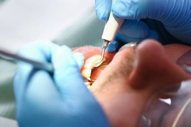 Best Root Canal Emergency Dentist  in River Grove, IL