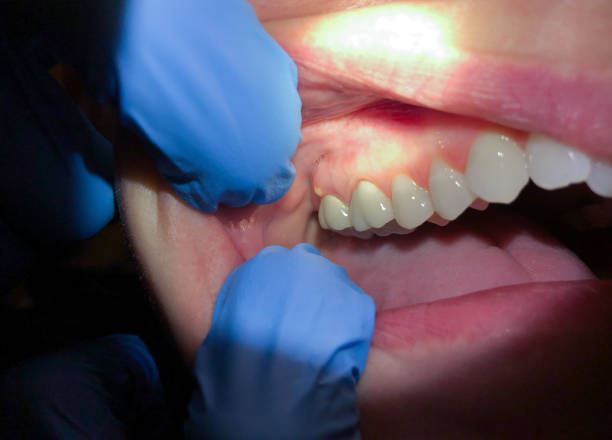 Best Broken Tooth Emergency  in River Grove, IL